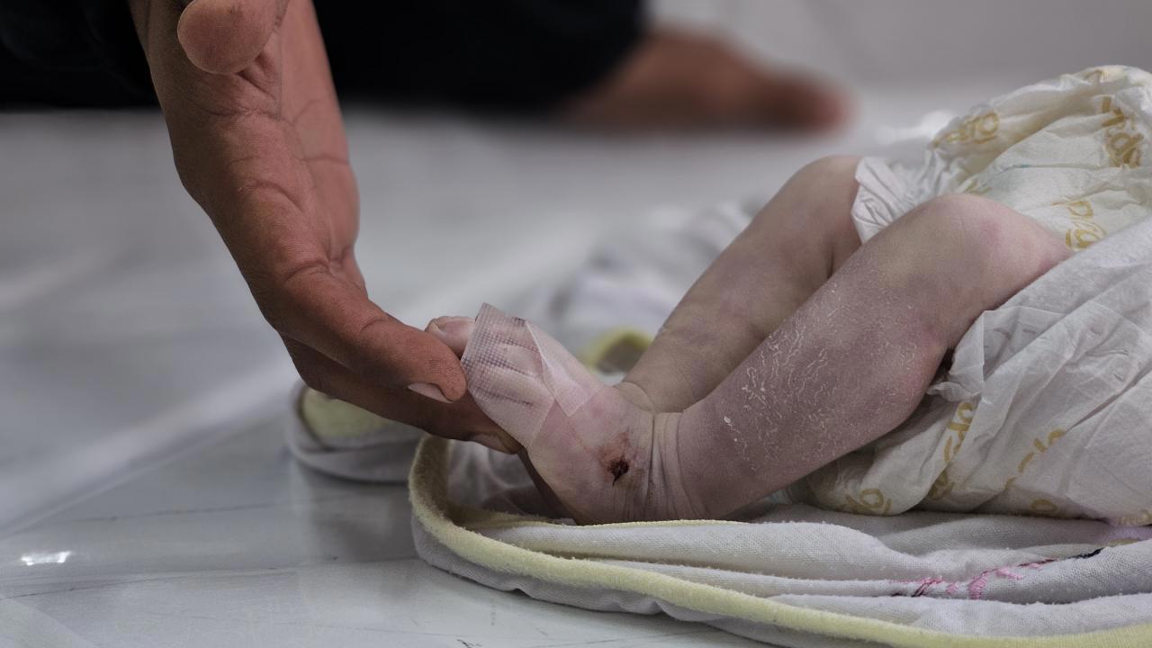 Gazze'de Donarak Ölen 6 Bebek