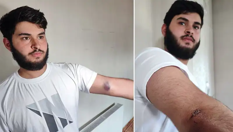 Bahçeye Kaçan Top, Mahallede Gergin Anlar Yaşattı: Conolar Kamyonetle Geldi!